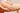 Cellulite sur les cuisses
