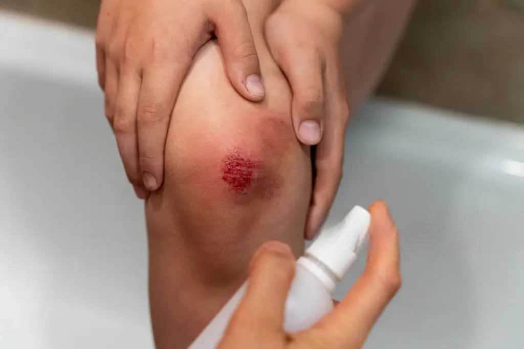 Verletztes Knie